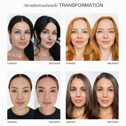 B-Shade™ Foundation